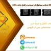 دیتاست DDTI تصاویر سونوگرافی تیروئید با فایل های XML 1 دیتاست DDTI تصاویر سونوگرافی تیروئید با فایل های XML