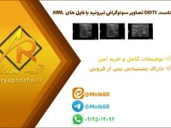 دیتاست DDTI تصاویر سونوگرافی تیروئید با فایل های XML
